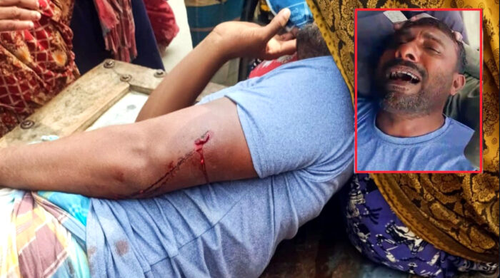 চাঁদা না দেওয়ায় যুবককে অপহরণ করে হাতুড়িপেটা, যশোর সদর হাসপাতালে প্রেরণ